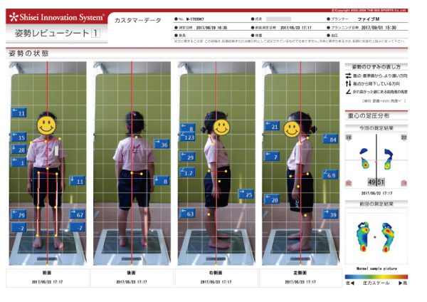 ６歳こどもの姿勢測定