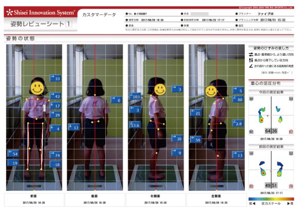 ６歳こども姿勢測定２回目