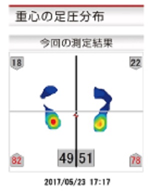 ６歳こどもの足圧