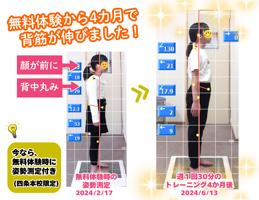 4ヶ月で猫背改善