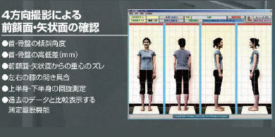 4方向の姿勢撮影により、姿勢の歪みがミリ単位でわかる