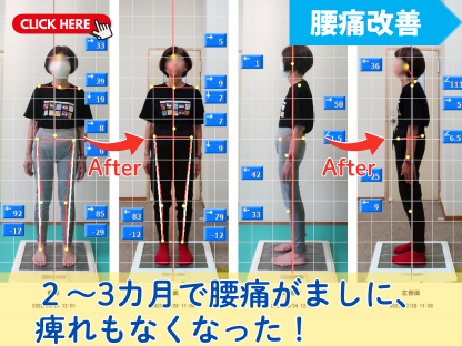 ２～３カ月で腰痛がましに、
痺れもなくなった！